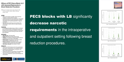 Thumbnail for EFFICACY OF PECTORALIS NERVE BLOCKS I & II WITH LIPOSOMAL BUPIVACAINE IN PATIENTS UNDERGOING ELECTIVE BREAST REDUCTION PROCEDURES