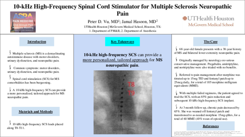 Preview of 10-KHZ HIGH-FREQUENCY SPINAL CORD STIMULATOR FOR MULTIPLE SCLEROSIS NEUROPATHIC PAIN