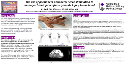 Preview of THE USE OF PERMANENT PERIPHERAL NERVE STIMULATION TO MANAGE CHRONIC PAIN AFTER A GRENADE INJURY.