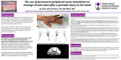 Thumbnail for THE USE OF PERMANENT PERIPHERAL NERVE STIMULATION TO MANAGE CHRONIC PAIN AFTER A GRENADE INJURY.