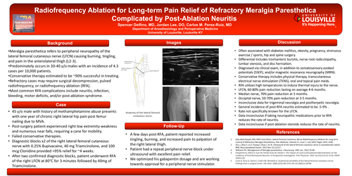 Preview of RADIO FREQUENCY ABLATION FOR LONG-TERM PAIN RELIEF OF REFRACTORY MERALGIA PARESTHETICA COMPLICATED BY POST-ABLATION NEURITIS