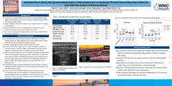 Thumbnail for INTERCOSTAL NERVE BLOCKS WITH LIPOSOMAL OR PLAIN BUPIVACAINE VS THORACIC PARAVERTEBRAL NERVE BLOCK FOR VATS: PRELIMINARY RESULTS