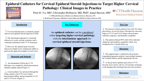 Preview of EPIDURAL CATHETERS FOR CERVICAL EPIDURAL STEROID INJECTIONS TO TARGET HIGHER CERVICAL PATHOLOGY