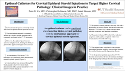 Thumbnail for EPIDURAL CATHETERS FOR CERVICAL EPIDURAL STEROID INJECTIONS TO TARGET HIGHER CERVICAL PATHOLOGY