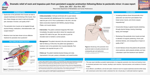 Preview of DRAMATIC RELIEF OF NECK AND TRAPEZIUS PAIN FROM PERSISTENT SCAPULAR PROTRACTION FOLLOWING BOTOX TO PECTORALIS MINOR: A CASE REPORT
