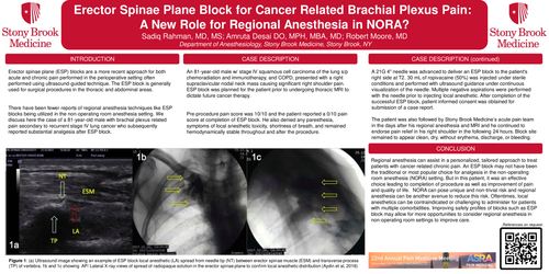 Preview of ERECTOR SPINAE PLANE BLOCK FOR CANCER RELATED BRACHIAL PLEXUS PAIN - A NEW ROLE FOR REGIONAL ANESTHESIA IN NORA?