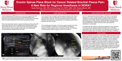 Thumbnail for ERECTOR SPINAE PLANE BLOCK FOR CANCER RELATED BRACHIAL PLEXUS PAIN - A NEW ROLE FOR REGIONAL ANESTHESIA IN NORA?