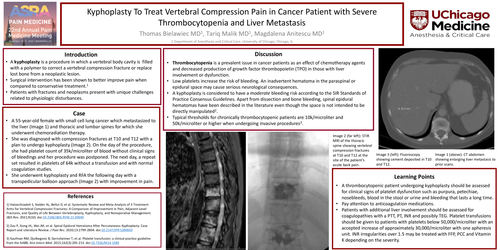 Preview of KYPHOPLASTY TO TREAT VERTEBRAL COMPRESSION PAIN IN CANCER PATIENT WITH SEVERE THROMBOCYTOPENIA AND LIVER METASTASIS
