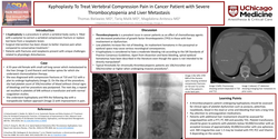 Thumbnail for KYPHOPLASTY TO TREAT VERTEBRAL COMPRESSION PAIN IN CANCER PATIENT WITH SEVERE THROMBOCYTOPENIA AND LIVER METASTASIS
