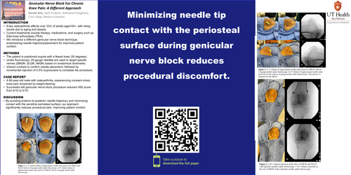 Preview of GENICULAR NERVE BLOCK FOR CHRONIC KNEE PAIN: A DIFFERENT APPROACH