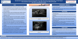 Thumbnail for SYMPTOMATIC IMPROVEMENT OF CHRONIC NEUROPATHIC PAIN AFTER ULNAR NERVE HYDRODISSECTION: A CASE REPORT