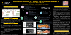 Thumbnail for PERIPHERAL NERVE STIMULATION FOR A REFRACTORY CASE OF POST-HERPETIC NEURALGIA IN THE UPPER LIMB: A CASE REPORT
