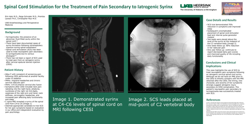 Preview of SPINAL CORD STIMULATION FOR THE TREATMENT OF PAIN SECONDARY TO IATROGENIC SYRINX