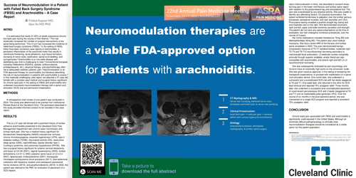 Preview of SUCCESS OF NEUROMODULATION IN A PATIENT WITH FAILED BACK SURGERY SYNDROME (FBSS) AND ARACHNOIDITIS – A CASE REPORT