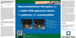 Thumbnail for SUCCESS OF NEUROMODULATION IN A PATIENT WITH FAILED BACK SURGERY SYNDROME (FBSS) AND ARACHNOIDITIS – A CASE REPORT