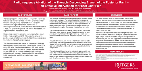Preview of RADIOFREQUENCY ABLATION OF THE THORACIC DESCENDING BRANCH OF THE POSTERIOR RAMI - AN EFFECTIVE INTERVENTION FOR FACET JOINT PAIN