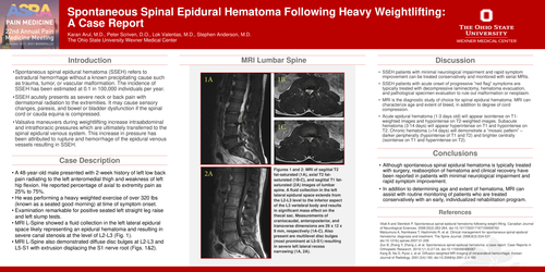 Preview of SPONTANEOUS SPINAL EPIDURAL HEMATOMA FOLLOWING HEAVY WEIGHTLIFTING: A CASE REPORT