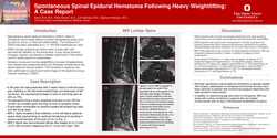 Thumbnail for SPONTANEOUS SPINAL EPIDURAL HEMATOMA FOLLOWING HEAVY WEIGHTLIFTING: A CASE REPORT