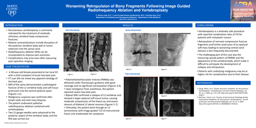 Preview of WORSENING RETROPULSION OF BONY FRAGMENTS FOLLOWING IMAGE GUIDED RADIOFREQUENCY ABLATION AND VERTEBROPLASTY