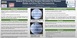 Thumbnail for BILATERAL S3 DORSAL ROOT GANGLION STIMULATION FOR PHANTOM BLADDER AND PELVIC PAIN POST-CYSTECTOMY