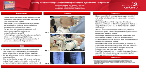 Preview of EXPANDING ACCESS: FLUOROSCOPIC GUIDED LUMBAR EPIDURAL STEROID INJECTION IN THE SITTING POSITION