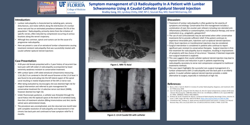 Preview of SYMPTOM MANAGEMENT OF L3 RADICULOPATHY IN A PATIENT WITH A LUMBAR SCHWANNOMA USING A CAUDAL CATHETER EPIDURAL STEROID INJECTION