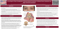 Thumbnail for A CASE REPORT OF RARE COMPLICATION FOLLOWING EPIDURAL ANESTHESIA: UNILATERAL HORNER SYNDROME AND UPPER EXTREMITY PARESTHESIA
