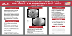 Thumbnail for RETROGRADE SPINAL CORD STIMULATOR PLACEMENT AS A SALVAGE TECHNIQUE