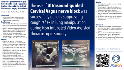 Preview of ULTRASOUND-GUIDED CERVICAL VAGUS NERVE BLOCK FOR COUGH SUPPRESSION IN A NON-INTUBATED VATS: A CASE REPORT