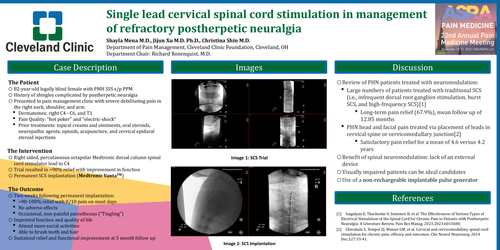 Preview of SINGLE LEAD CERVICAL SPINAL CORD STIMULATION IN MANAGEMENT OF REFRACTORY POSTHERPETIC NEURALGIA