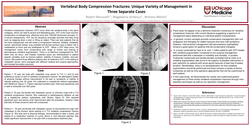 Thumbnail for VERTEBRAL BODY COMPRESSION FRACTURES: UNIQUE VARIETY OF MANAGEMENT IN THREE SEPARATE CASES