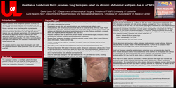 Thumbnail for QUADRATUS LUMBORUM BLOCK PROVIDES LONG TERM PAIN RELIEF IN CHRONIC ABDOMINAL WALL PAIN DUE TO ACNES
