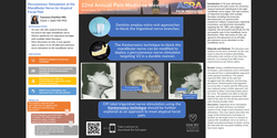 Thumbnail for PERCUTANEOUS STIMULATION OF THE MANDIBULAR NERVE FOR ATYPICAL FACIAL PAIN