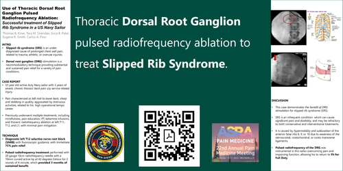 Preview of SUCCESSFUL USE OF THORACIC DORSAL ROOT GANGLION PULSED RADIOFREQUENCY ABLATION TO TREAT SLIPPED RIB SYNDROME IN A NAVY SAILOR