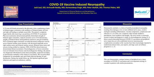 Preview of COVID-19 VACCINE INDUCED NEUROPATHY