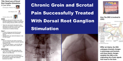 Thumbnail for NOVEL USES OF DORSAL ROOT GANGLION STIMULATION:  A CASE SERIES
