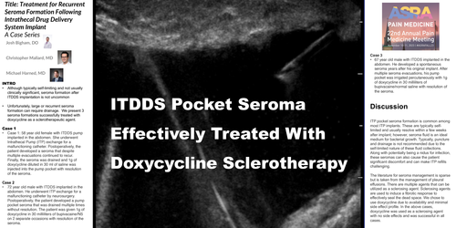 Preview of TREATMENT FOR SEROMA FORMATION FOLLOWING INTRATHECAL DRUG DELIVERY SYSTEM IMPLANT IN THE ABDOMEN: A CASE SERIES