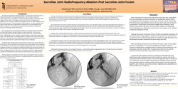 Thumbnail for SACROILIAC JOINT RADIOFREQUENCY ABLATION POST SACROILIAC JOINT FUSION