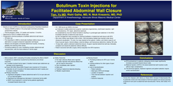 Thumbnail for BOTULINUM TOXIN INJECTION FOR FACILITATED ABDOMINAL WALL CLOSURE