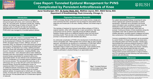 Preview of TUNNELED EPIDURAL MANAGEMENT FOR PVNS COMPLICATED BY PERSISTENT ARTHROFIBROSIS OF KNEE