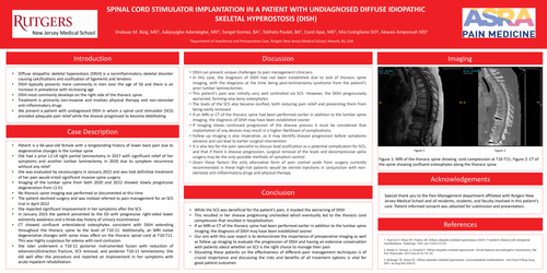 Preview of SPINAL CORD STIMULATOR IMPLANTATION IN A PATIENT WITH UNDIAGNOSED DIFFUSE IDIOPATHIC SKELETAL HYPEROSTOSIS (DISH)