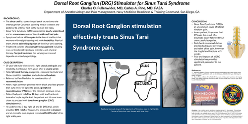 Preview of DORSAL ROOT GANGLION (DRG) STIMULATOR FOR THE TREATMENT OF SINUS TARSI SYNDROME.
