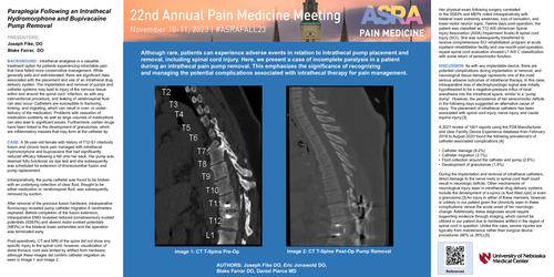 Preview of PARAPLEGIA FOLLOWING AN INTRATHECAL HYDROMORPHONE AND BUPIVACAINE PUMP REMOVAL