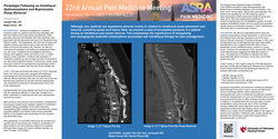 Thumbnail for PARAPLEGIA FOLLOWING AN INTRATHECAL HYDROMORPHONE AND BUPIVACAINE PUMP REMOVAL