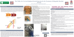 Thumbnail for THE UTILITY OF AN INTERLAMINAR EPIDURAL STEROID INJECTION FOR THE TREATMENT OF IDIOPATHIC BRACHIAL NEURITIS