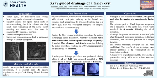 Preview of XRAY GUIDED DRAINAGE OF A TARLOV CYST