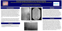 Thumbnail for DORSAL ROOT GANGLION STIMULATION FOR THE TREATMENT OF HIP PAIN