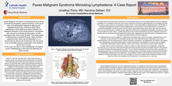 Thumbnail for PSOAS MALIGNANT SYNDROME MIMICKING LYMPHEDEMA: A CASE REPORT