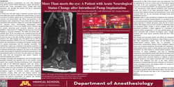 Thumbnail for MORE THAN MEETS THE EYE: A PATIENT WITH ACUTE NEUROLOGICAL STATUS CHANGE AFTER INTRATHECAL PUMP IMPLANTATION