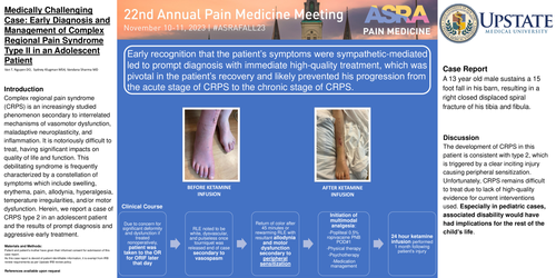 Preview of EARLY DIAGNOSIS AND MANAGEMENT OF COMPLEX REGIONAL PAIN SYNDROME TYPE II IN AN ADOLESCENT PATIENT